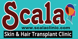 Low Cost Hair Transplant in Hyderabad  